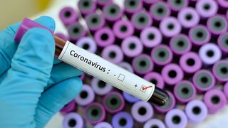 Греция подтверждает сообщения о коронавирусе в Салониках